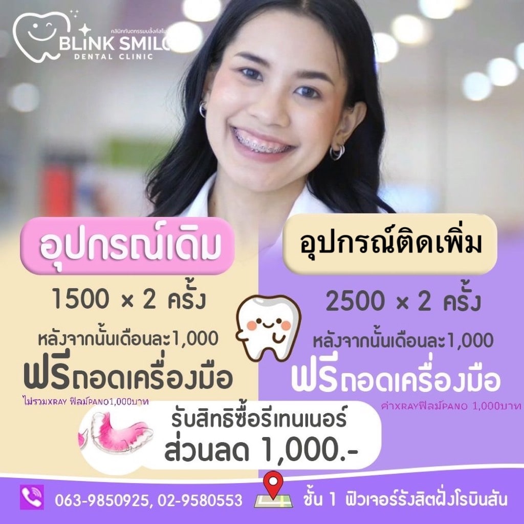 โปรโมชั่นจัดฟัน อุปกรณ์เดิมและอุปกรณ์ติดเพิ่ม จาก Blink Smile Dental Clinic